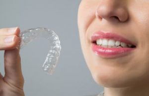 Answers to Your Invisalign Questions